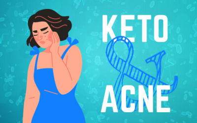 Keto and Acne: Cause or Treatment?